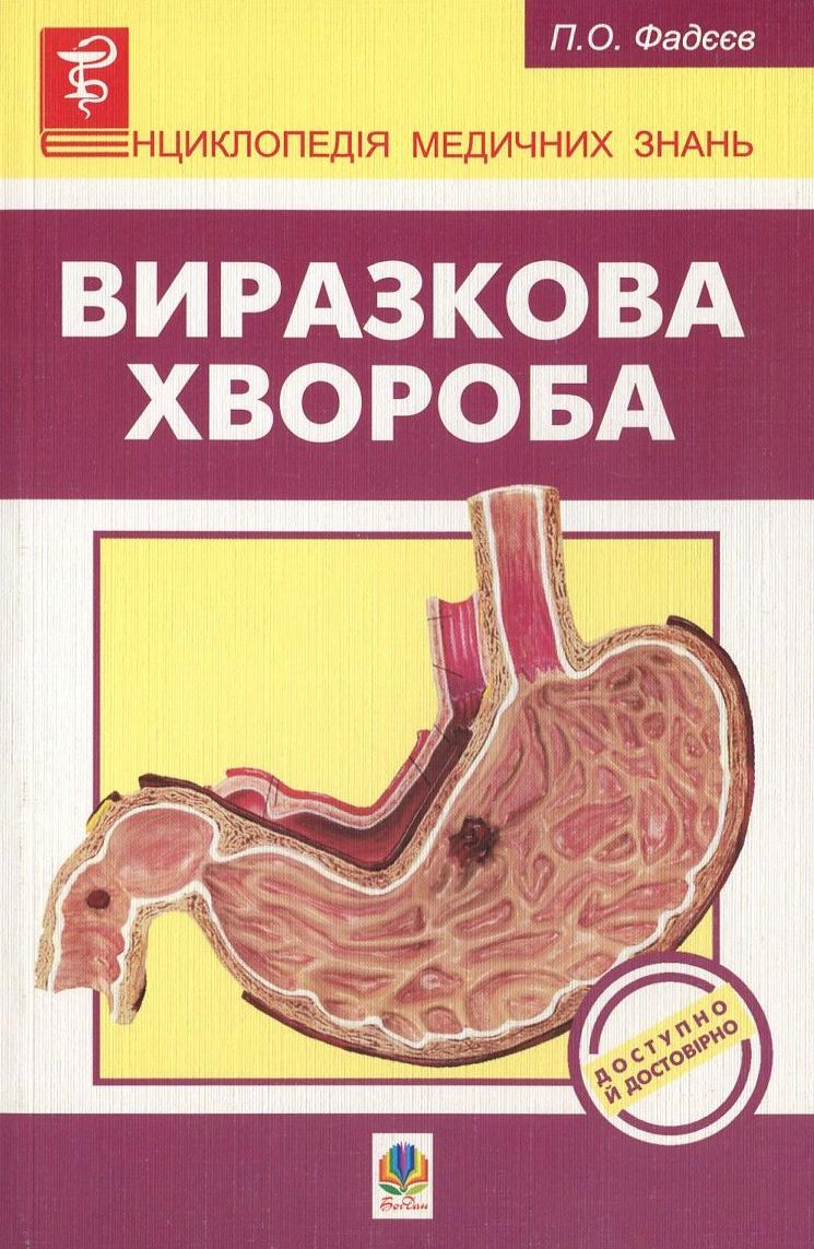 Виразкова хвороба